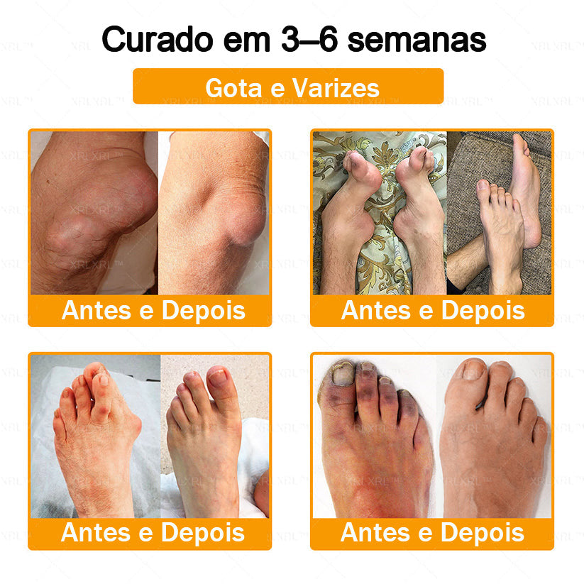 XRLXRL® Creme Reparador Ósseo e Alívio da Dor com Veneno de Abelha (Especialmente desenvolvido para pessoas idosas)